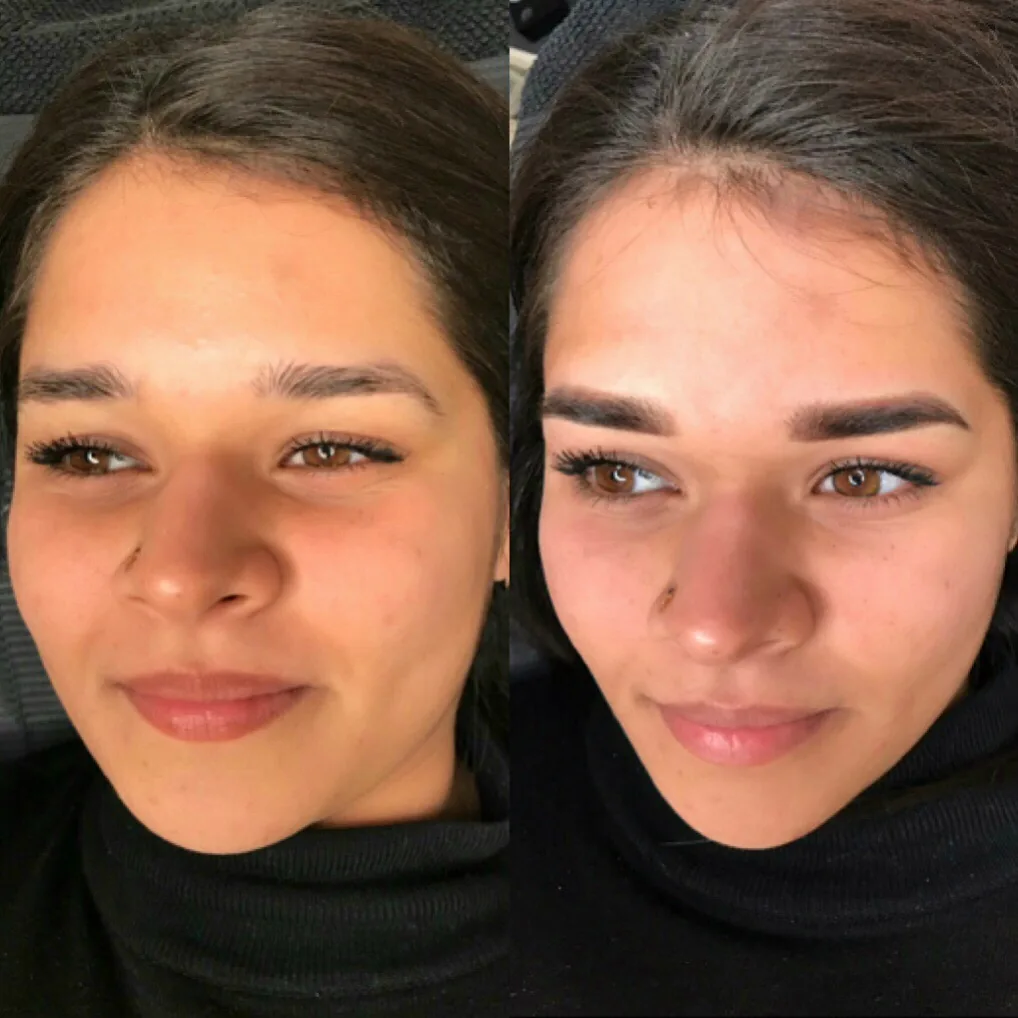 Før og efter permanent makeup, set forfra